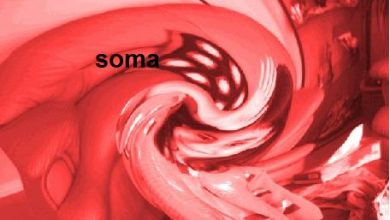 so
